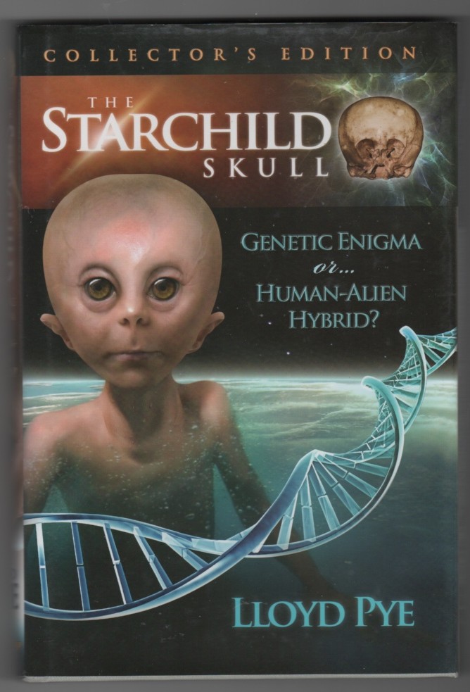 Image for The Starchild Skull Genetic Enigma or...Human-Alien Hybrid?